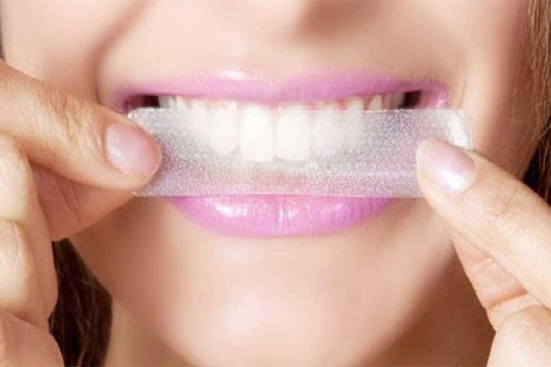 Parhaiden hampaiden valkaisuliuskojen sijoitus vuodelle 2020