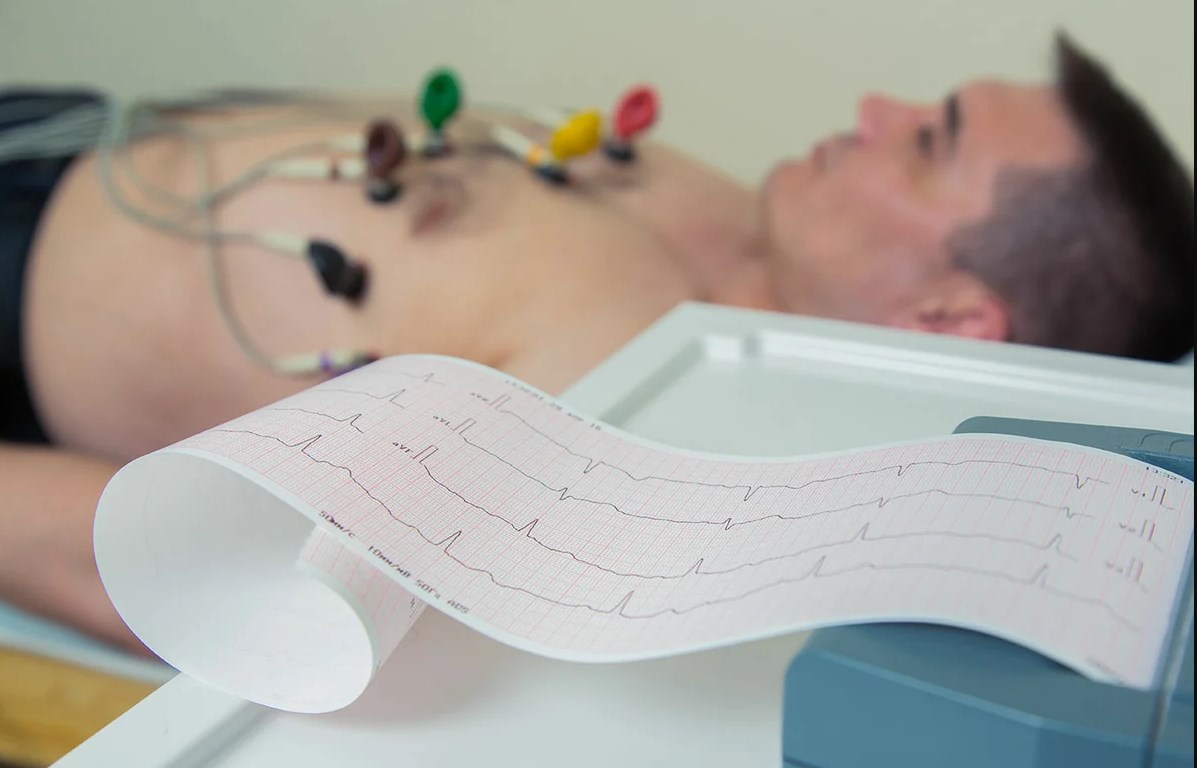 Rating of the best electrocardiographs for 2020